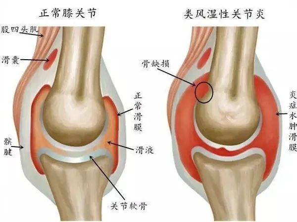 弘億康中醫(yī)定向透藥治療儀骨關(guān)節(jié)