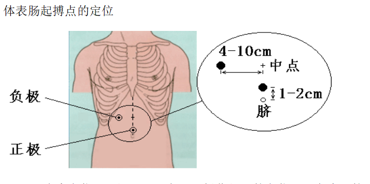 胃腸動(dòng)力治療儀起搏點(diǎn)定位